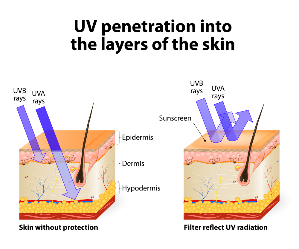 what-is-sunburn-winslow-skincare